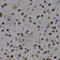 Myocyte Enhancer Factor 2C antibody, A2585, ABclonal Technology, Immunohistochemistry paraffin image 