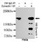Dynactin Subunit 1 antibody, GTX49164, GeneTex, Immunoprecipitation image 