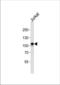 MER Proto-Oncogene, Tyrosine Kinase antibody, TA324995, Origene, Western Blot image 