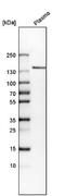 Collagen Type XIV Alpha 1 Chain antibody, NBP1-86877, Novus Biologicals, Western Blot image 
