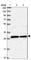 BCDIN3 Domain Containing RNA Methyltransferase antibody, HPA039911, Atlas Antibodies, Western Blot image 