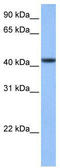 Chromosome 8 Open Reading Frame 34 antibody, TA340225, Origene, Western Blot image 