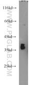 Cone-Rod Homeobox antibody, 12047-1-AP, Proteintech Group, Western Blot image 