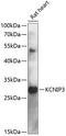 KChIP3 antibody, orb538005, Biorbyt, Western Blot image 