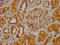 Cholinergic Receptor Nicotinic Beta 2 Subunit antibody, LS-C670793, Lifespan Biosciences, Immunohistochemistry paraffin image 