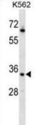 RAD1 Checkpoint DNA Exonuclease antibody, abx028531, Abbexa, Western Blot image 