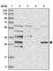 CDV3 Homolog antibody, PA5-56251, Invitrogen Antibodies, Western Blot image 