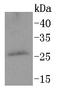 Protein Phosphatase 1 Regulatory Inhibitor Subunit 1A antibody, A11390, Boster Biological Technology, Western Blot image 