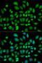 cAMP-specific 3 ,5 -cyclic phosphodiesterase 4D antibody, LS-C748953, Lifespan Biosciences, Immunofluorescence image 