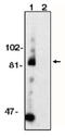 ADAM Metallopeptidase Domain 10 antibody, AP05089PU-N, Origene, Western Blot image 