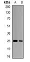 Glutathione S-Transferase Omega 2 antibody, orb340971, Biorbyt, Western Blot image 