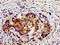 Dihydroorotate Dehydrogenase (Quinone) antibody, LS-C670019, Lifespan Biosciences, Immunohistochemistry paraffin image 