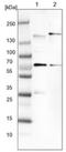 NBR1 Autophagy Cargo Receptor antibody, NBP1-89399, Novus Biologicals, Western Blot image 