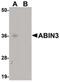 TNFAIP3 Interacting Protein 3 antibody, PA5-20798, Invitrogen Antibodies, Western Blot image 
