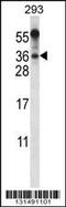 BEN Domain Containing 6 antibody, 56-523, ProSci, Western Blot image 