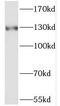 RNA Polymerase III Subunit B antibody, FNab06630, FineTest, Western Blot image 
