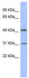 Glyceraldehyde-3-phosphate dehydrogenase, testis-specific antibody, TA345676, Origene, Western Blot image 