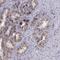 Angiopoietin 1 antibody, NBP1-90170, Novus Biologicals, Immunohistochemistry paraffin image 