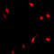 p65 antibody, LS-C352803, Lifespan Biosciences, Immunofluorescence image 