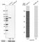 Polypeptide N-acetylgalactosaminyltransferase 6 antibody, HPA011762, Atlas Antibodies, Western Blot image 