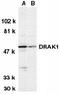 Serine/Threonine Kinase 17a antibody, TA306006, Origene, Western Blot image 