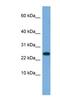 Ankyrin Repeat Domain 39 antibody, NBP1-79652, Novus Biologicals, Western Blot image 