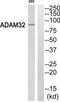 ADAM Metallopeptidase Domain 32 antibody, TA312063, Origene, Western Blot image 