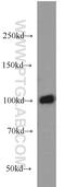Cyclic Nucleotide Gated Channel Alpha 3 antibody, 21657-1-AP, Proteintech Group, Western Blot image 