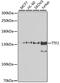 Transcription Termination Factor 2 antibody, A7751, ABclonal Technology, Western Blot image 