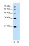 Arginine And Serine Rich Coiled-Coil 2 antibody, NBP1-54332, Novus Biologicals, Western Blot image 
