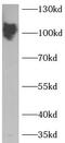 SDC antibody, FNab01423, FineTest, Western Blot image 