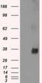 NIMA Related Kinase 6 antibody, NBP1-47865, Novus Biologicals, Western Blot image 