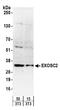 Exosome complex exonuclease RRP4 antibody, A303-886A, Bethyl Labs, Western Blot image 