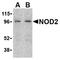 Phorbol-12-myristate-13-acetate-induced protein 1 antibody, AP05558PU-N, Origene, Western Blot image 