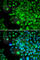 Four And A Half LIM Domains 1 antibody, A5460, ABclonal Technology, Immunofluorescence image 