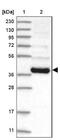 Ribonuclease P/MRP Subunit P40 antibody, NBP2-38260, Novus Biologicals, Western Blot image 
