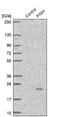 Phosphatidylinositol Glycan Anchor Biosynthesis Class H antibody, NBP1-83342, Novus Biologicals, Western Blot image 