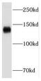 Fms Related Tyrosine Kinase 3 antibody, FNab03164, FineTest, Western Blot image 
