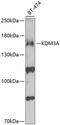 Jhdm2a antibody, GTX54313, GeneTex, Western Blot image 