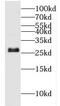 3-hydroxyacyl-CoA dehydrogenase type-2 antibody, FNab02823, FineTest, Western Blot image 