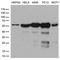 Serine/threonine-protein phosphatase 2B catalytic subunit alpha isoform antibody, LS-C799078, Lifespan Biosciences, Western Blot image 