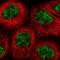 Steroid Receptor Associated And Regulated Protein antibody, NBP1-81157, Novus Biologicals, Immunofluorescence image 