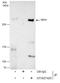 Tet Methylcytosine Dioxygenase 1 antibody, GTX627420, GeneTex, Immunoprecipitation image 
