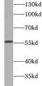 NLK antibody, FNab10496, FineTest, Western Blot image 