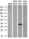 Baculoviral IAP Repeat Containing 7 antibody, M02577, Boster Biological Technology, Western Blot image 