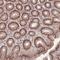 Zinc Finger BED-Type Containing 5 antibody, HPA050994, Atlas Antibodies, Immunohistochemistry paraffin image 