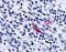 G Protein-Coupled Receptor 52 antibody, orb85736, Biorbyt, Immunohistochemistry paraffin image 