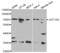 UDP Glucuronosyltransferase Family 1 Member A9 antibody, abx001396, Abbexa, Western Blot image 
