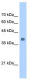 Aldolase, Fructose-Bisphosphate A antibody, TA346527, Origene, Western Blot image 