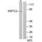 Kntc2 antibody, A01731-1, Boster Biological Technology, Western Blot image 
